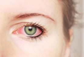 التهابات العين
